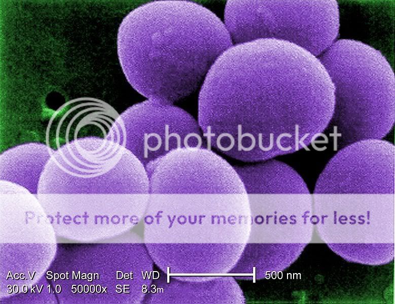 staphylococcus aureus gram stain. +saprophyticus+gram+stain